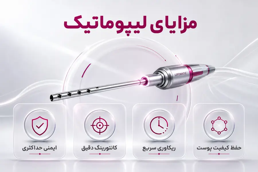 شاخص - مزایای لیپوماتیک