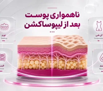 ناهمواری پوست بعد از لیپوساکشن