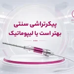 پیکرتراشی سنتی بهتر است یا لیپوماتیک؟ مقایسه کامل دو روش