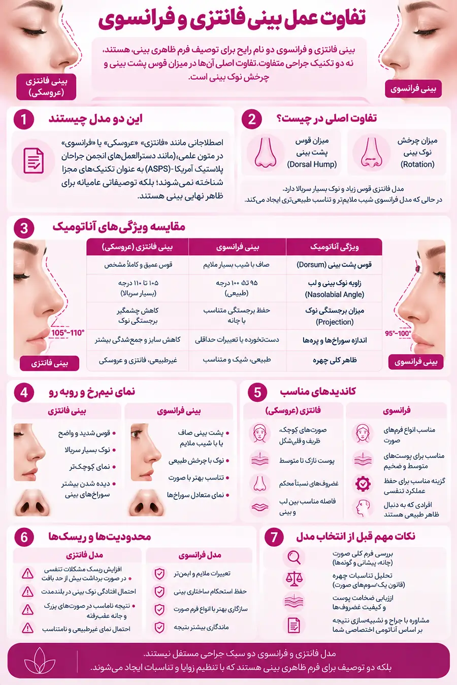 عمل بینی فانتزی و عروسکی؛ تفاوت بینی فانتزی و فرانسوی