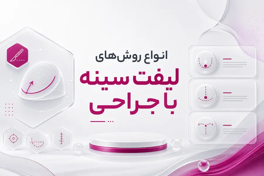 شاخص - انواع روش_های لیفت سینه با جراحی انواع روشهای لیفت سینه با جراحی؛ مقایسه برش هلالی، دوناتی، عمودی و لنگری