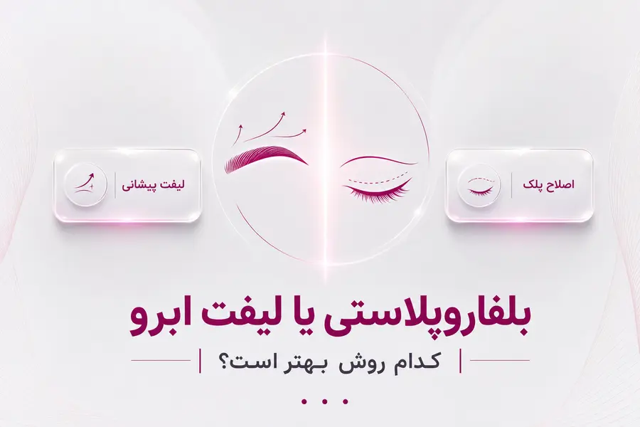 شاخص - بلفاروپلاستی یا لیفت ابرو _ کدام روش بهتر است؟ بلفاروپلاستی یا لیفت ابرو؛ کدام روش برای افتادگی چشم و ابرو مناسبتر است؟