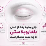جای بخیه بلفاروپلاستی چه زمانی محو می‌شود؟