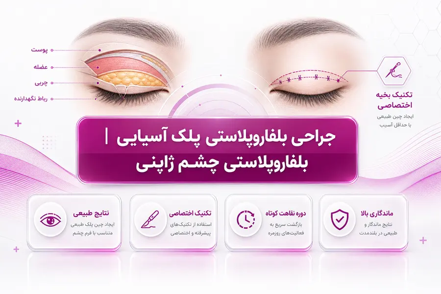 بلفاروپلاستی پلک آسیایی چیست؟ بررسی جراحی پلک ژاپنی و ایجاد چین پلک بلفاروپلاستی پلک آسیایی چیست؟ بررسی جراحی پلک ژاپنی و ایجاد چین پلک
