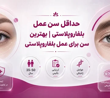 بهترین سن برای بلفاروپلاستی چه زمانی است؟ حداقل سن و زمان مناسب عمل پلک