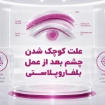 علت کوچک شدن چشم بعد از عمل بلفاروپلاستی چیست؟