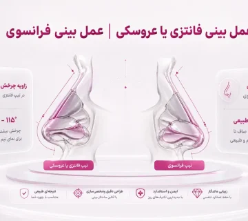 عمل بینی فانتزی و عروسکی؛ تفاوت بینی فانتزی و فرانسوی