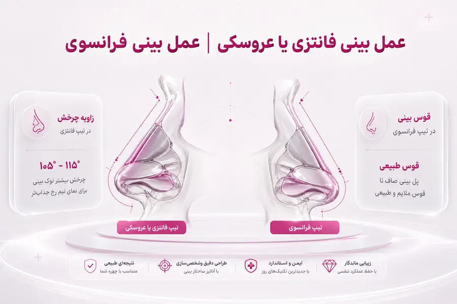 شاخص - عمل بینی فانتزی یا عروسکی _ عمل بینی فرانسوی عمل بینی فانتزی و عروسکی؛ تفاوت بینی فانتزی و فرانسوی