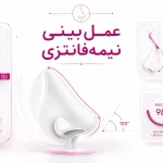 عمل بینی نیمه‌فانتزی چیست؟ ویژگی‌ها، مزایا و عوارض