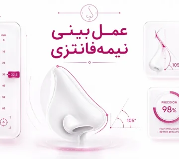 عمل بینی نیمه‌فانتزی چیست؟ ویژگی‌ها، مزایا و عوارض