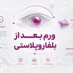 کاهش ورم چشم بعد از بلفاروپلاستی؛ زمان بهبودی و مراقبت‌ها